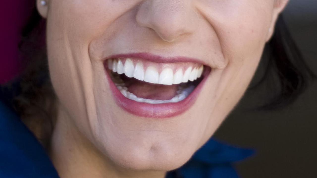 SmileDirectClub is being sued over health insurance claims for its teeth straighening kits.