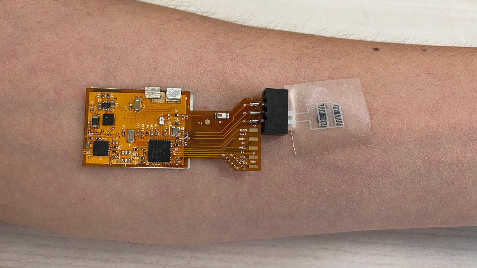 A-Patch skin adhesive system for sensing tuberculosis (Courtesy of Technion Spokesperson’s Office)